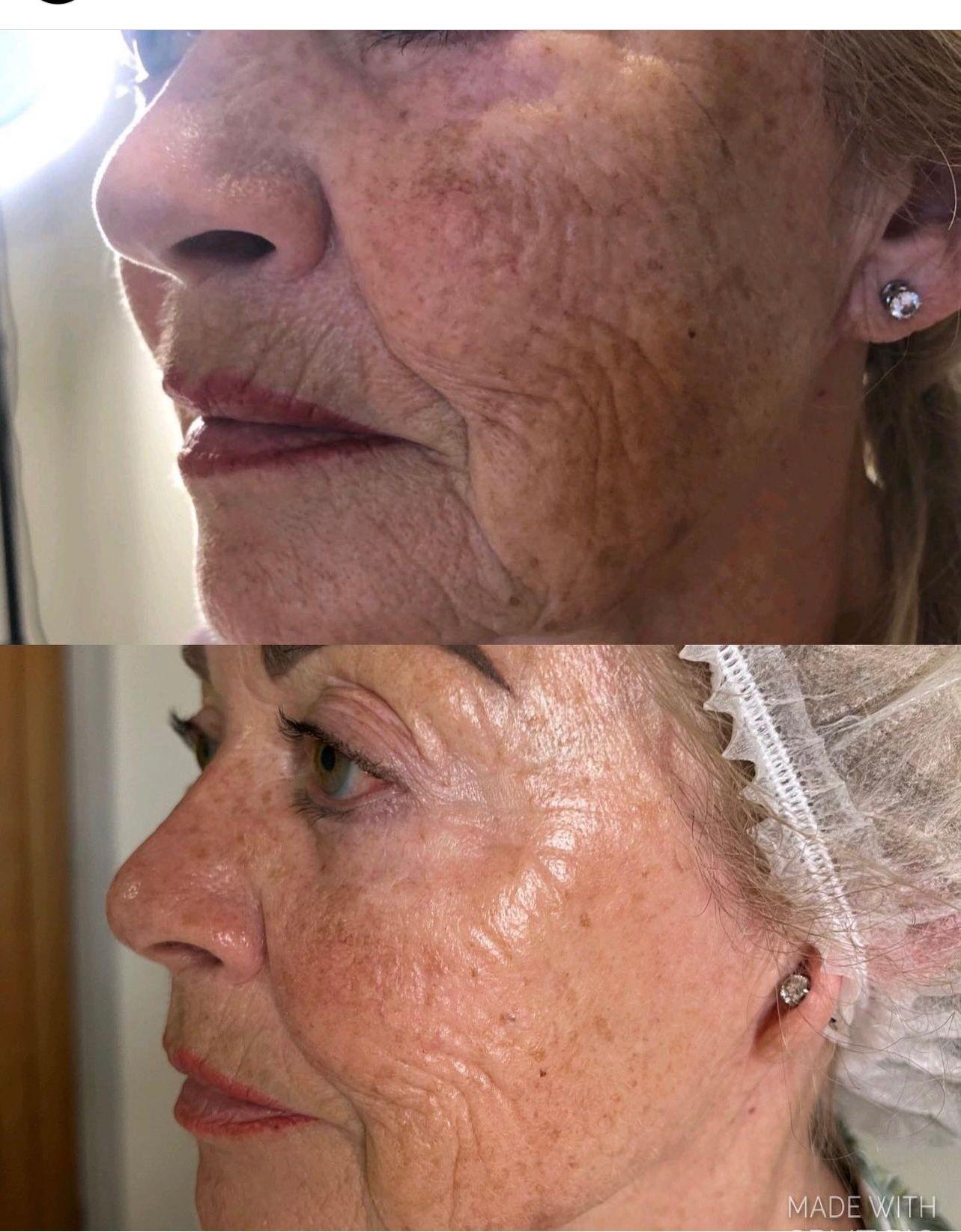 The Beauty spot image 3