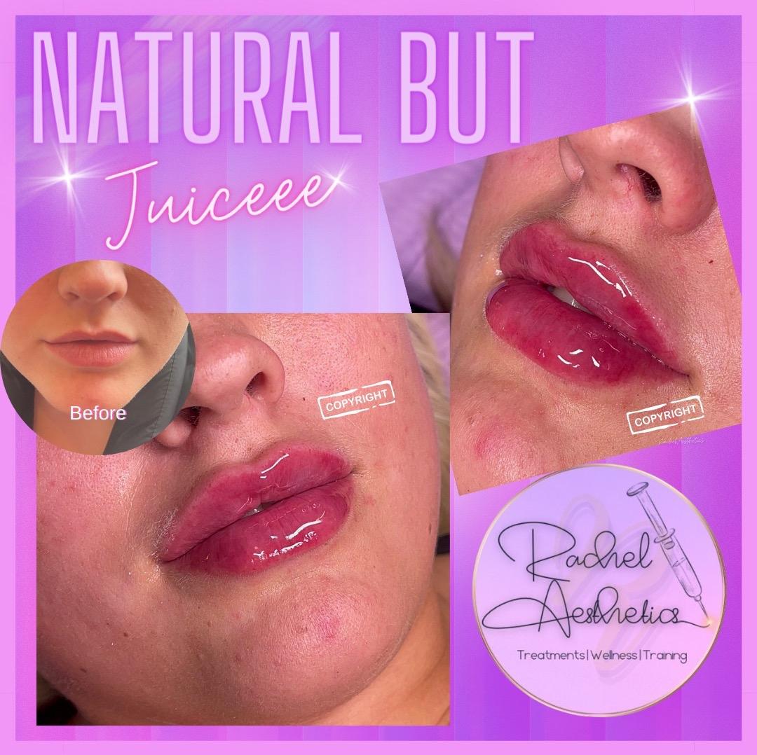 Rachel Aesthetics Treatments Wellness Training image 3