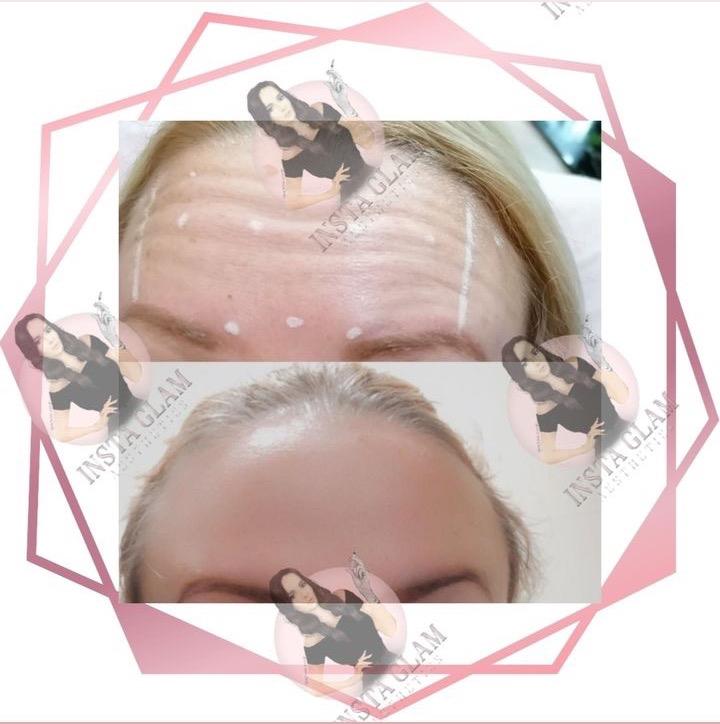 Insta Glam Aesthetics image 1