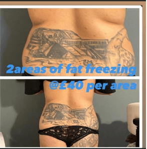 No 1 Bodysculpting image 3