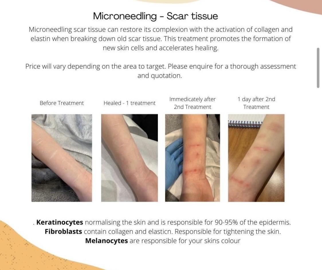 Verascious Skin image 2