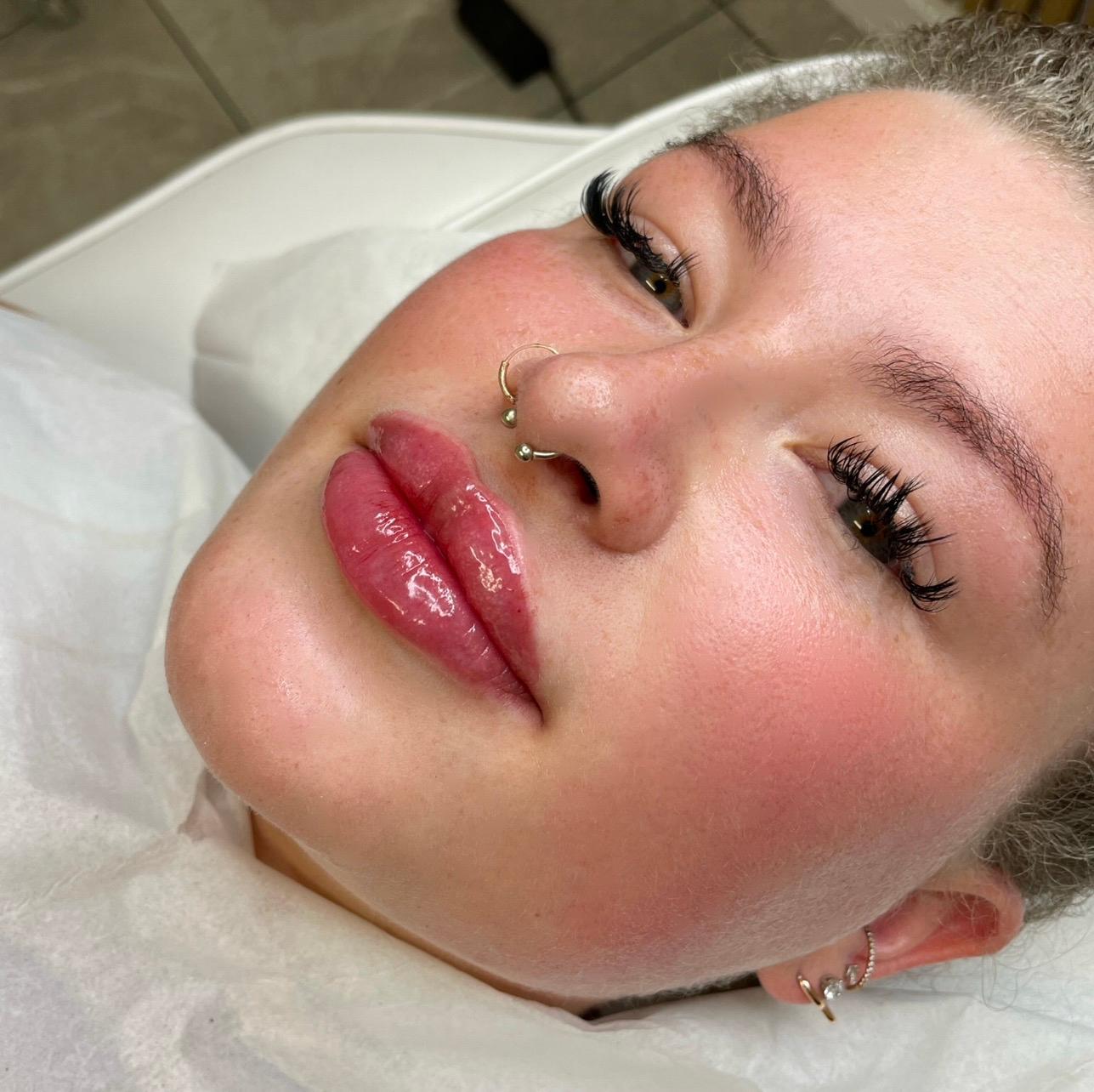 Derma Queen Aesthetics - Shrewsbury image 3