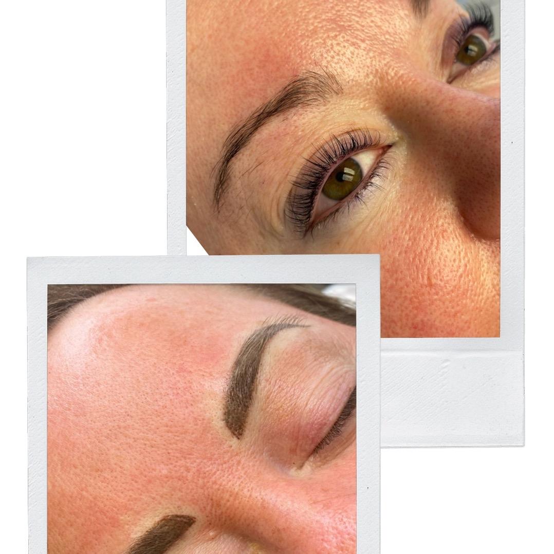 Cheryl Cosgrove Face Aesthetics image 3