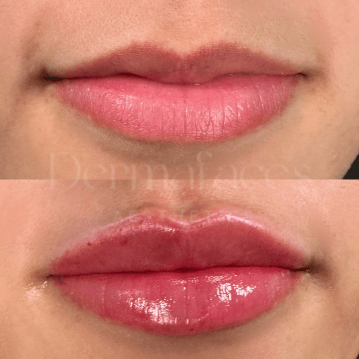 Dermafaces image 2