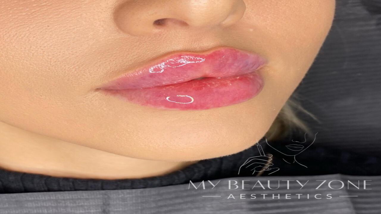 My Beauty Zone Aesthetics image 2