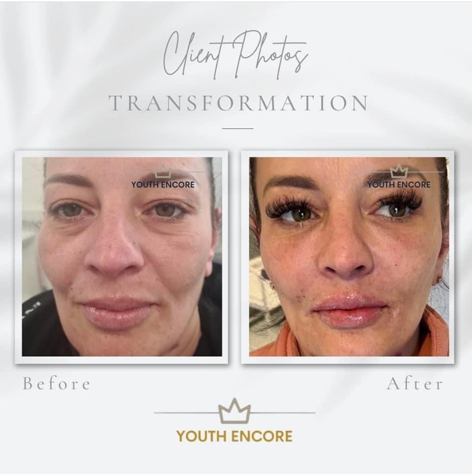 Youth Encore Aesthetic Clininc image 3