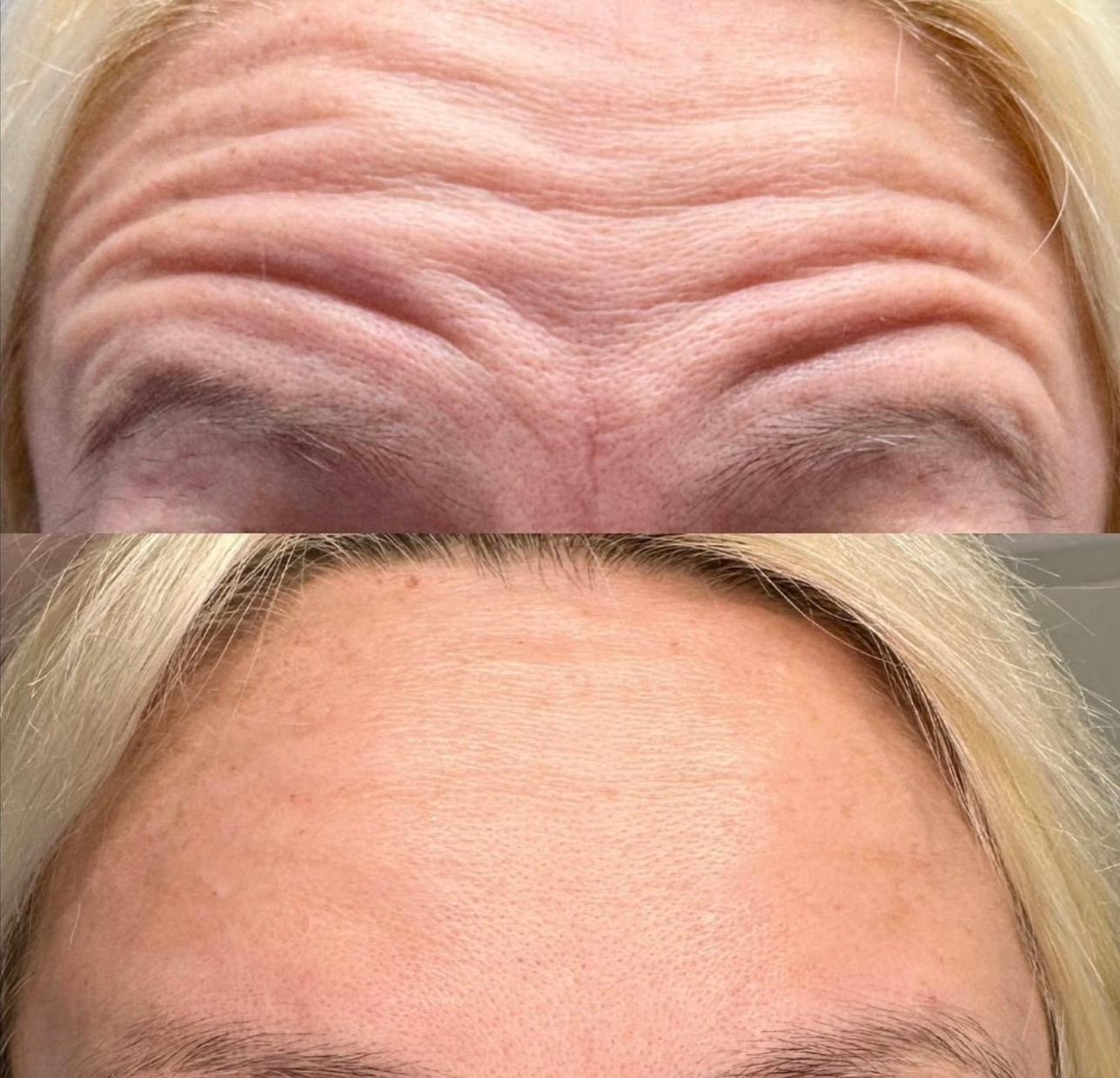 Lady young beauty and permanent makeup image 3