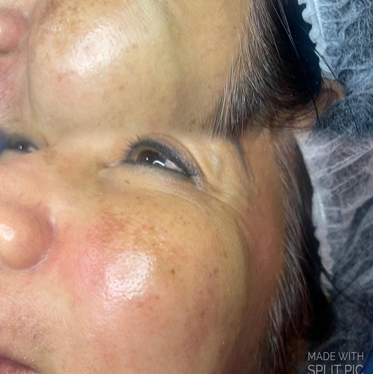Beayou clinic image 3