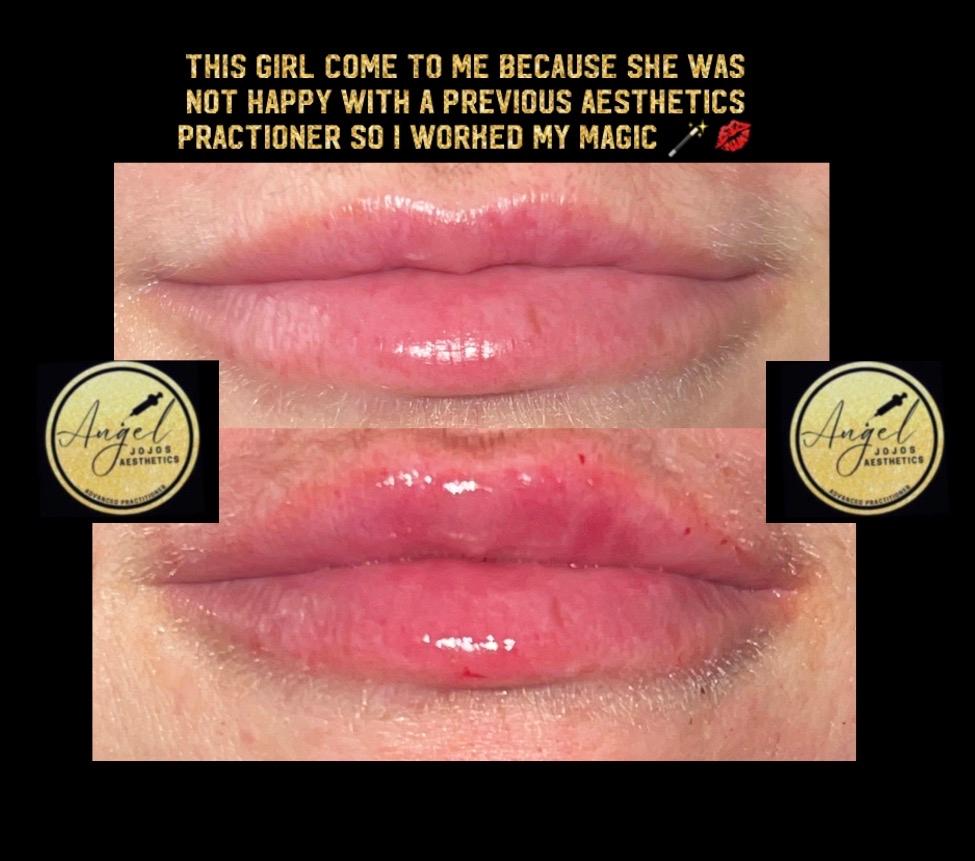 Angeljojosaestetics image 1