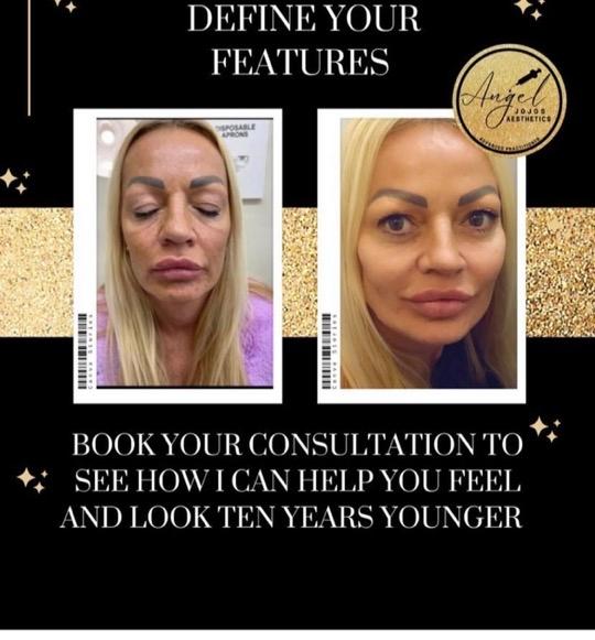 Angeljojosaestetics image 3