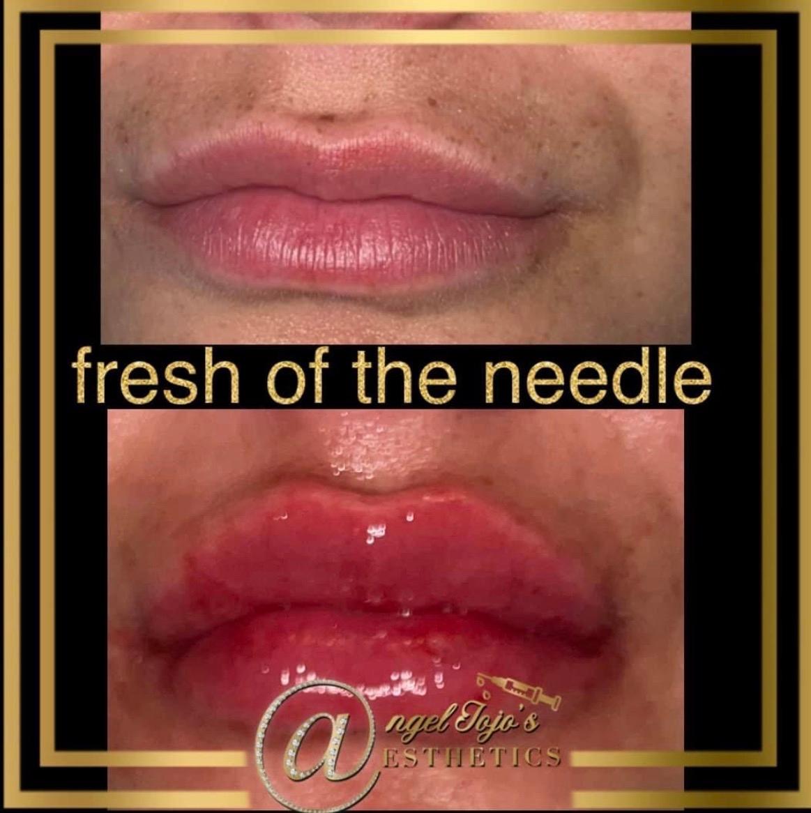 Angeljojosaestetics image 2