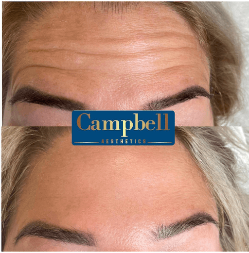 Campbell Aesthetics image 3