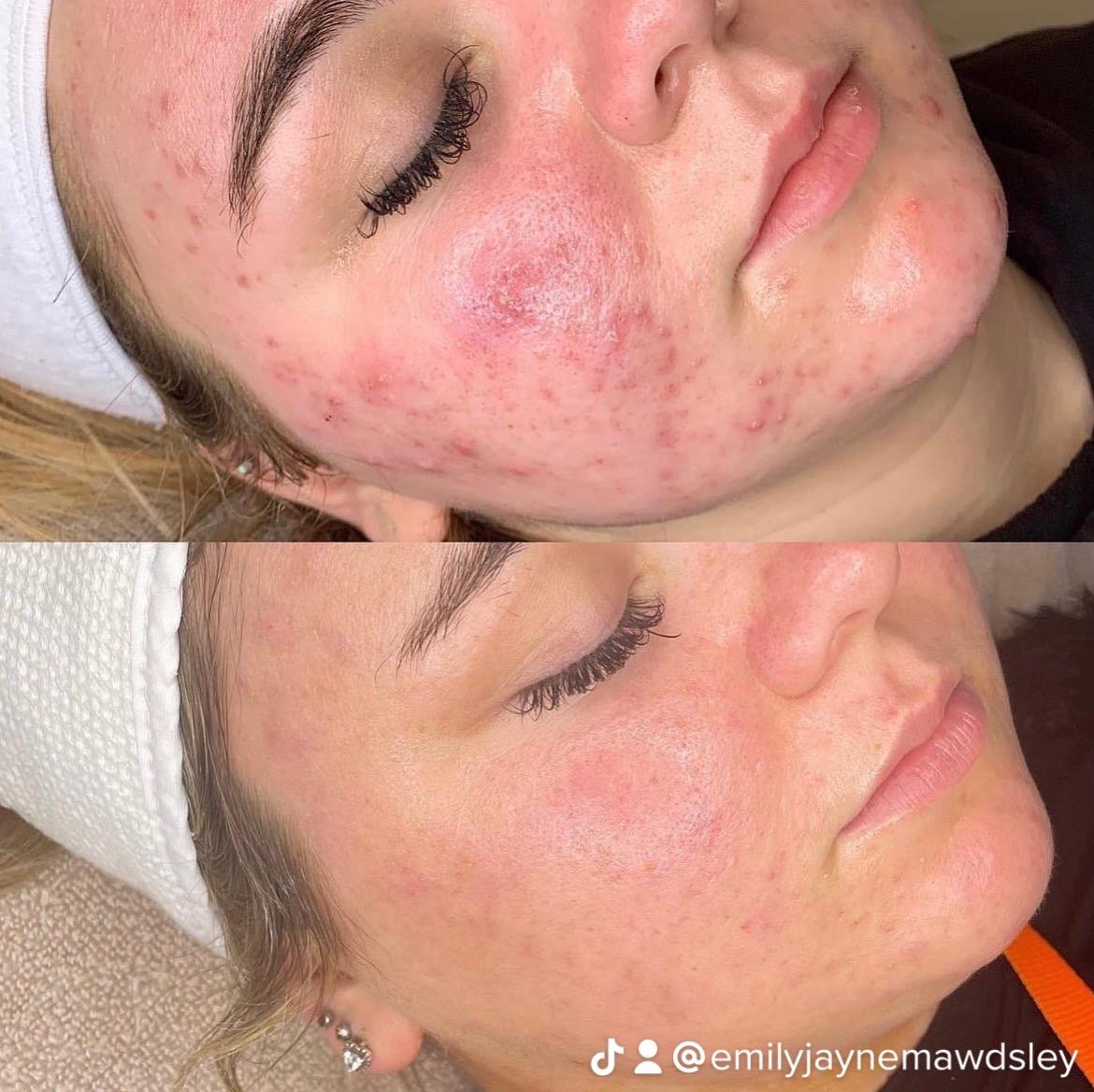 Emily Jayne Skin Revision image 2