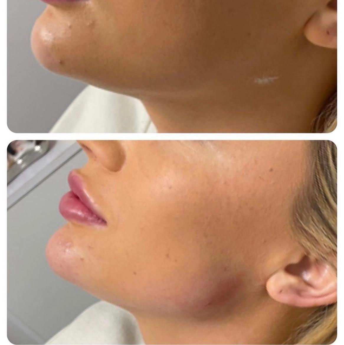 Ad skin therapy image 2