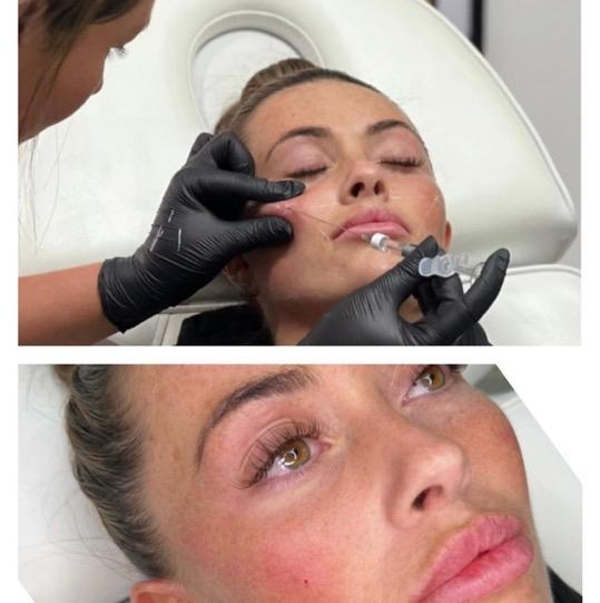 Ad skin therapy image 3