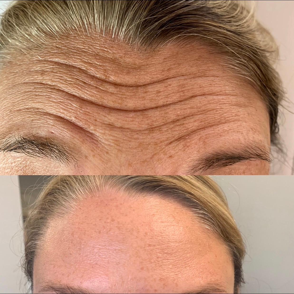 Blush Aesthetics Beauty image 3