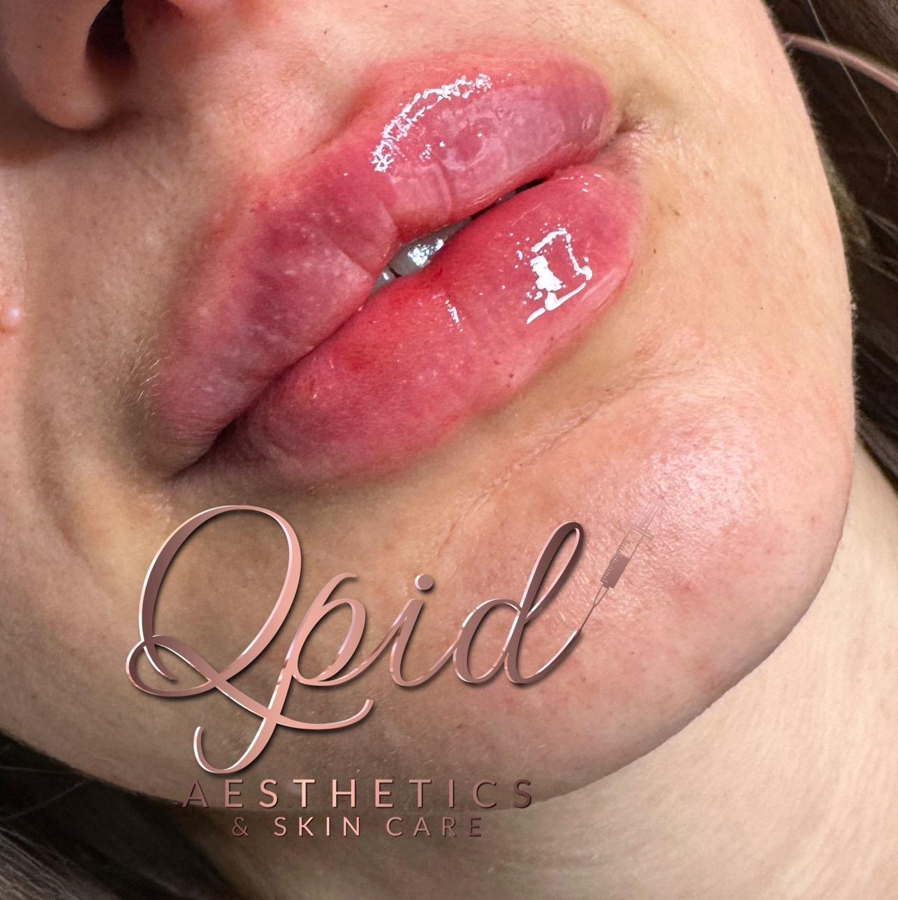 Qpid Aesthetics beauty image 1