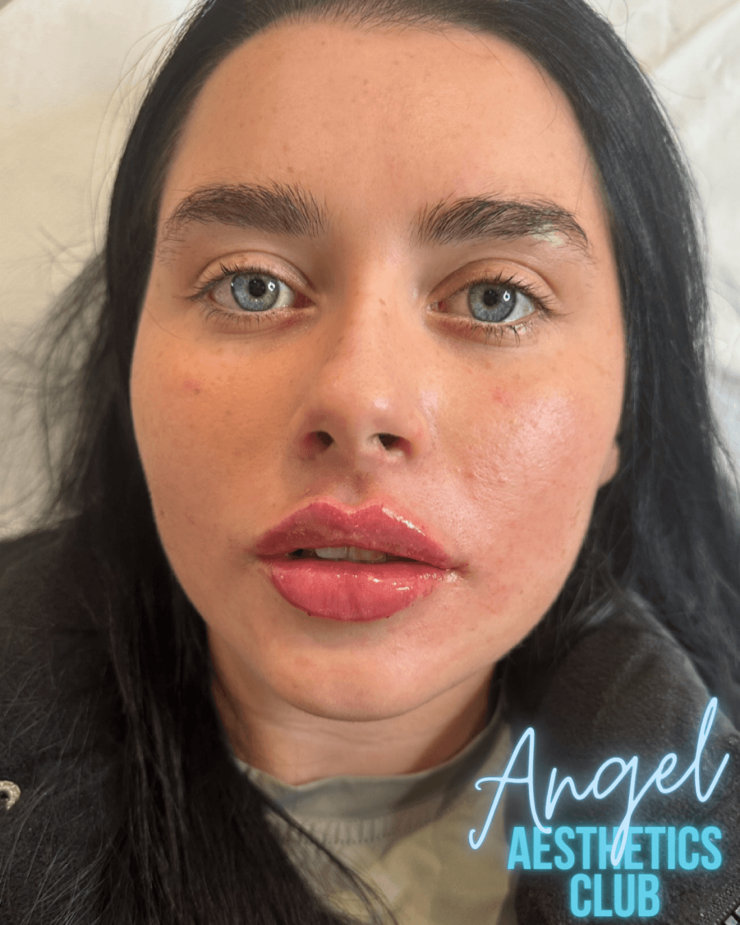 ANGEL AESTHETICS LIVERPOOL LIMITED image 1