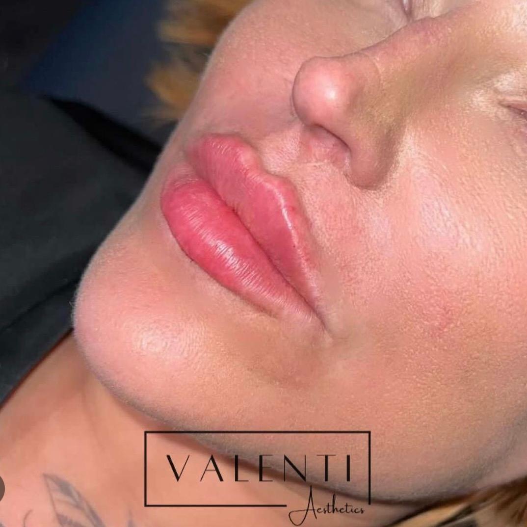 Valenti Aesthetics image 3