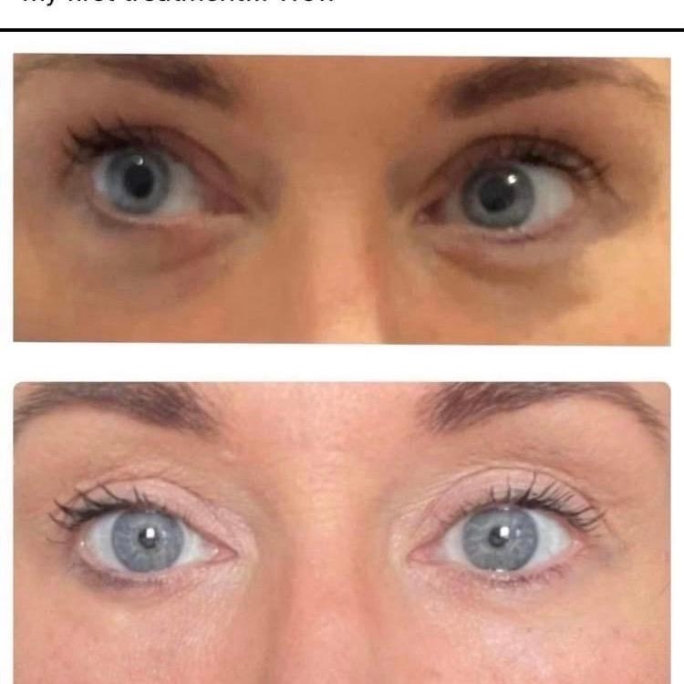 LG Enhance Aesthetics image 2