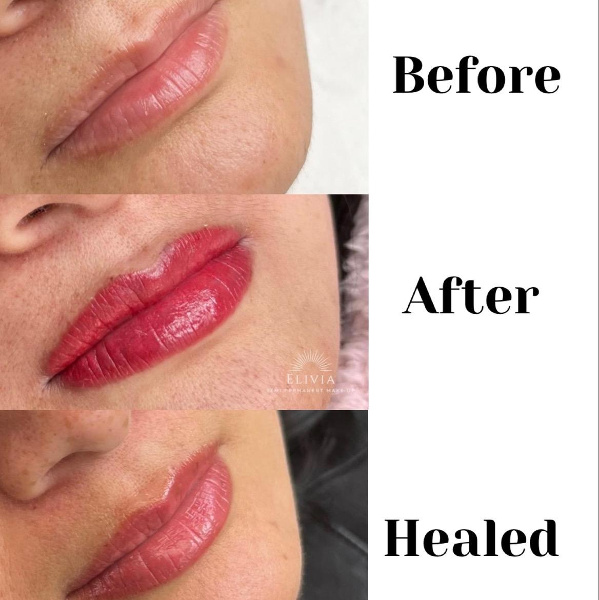 Carmelle Lea Beauty Clinic image 3