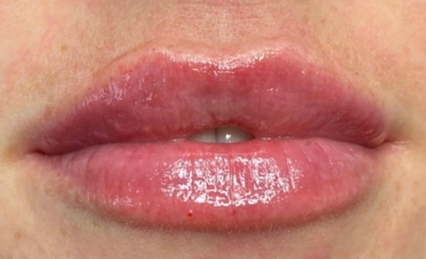 Allura Facial Aesthetics image 3