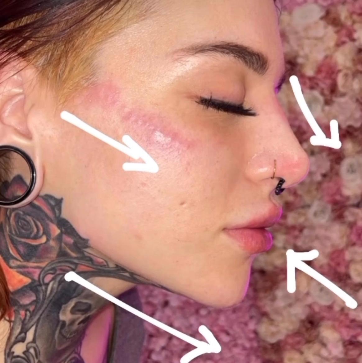 Glow Up With Maya Aesthetics Clinic image 2