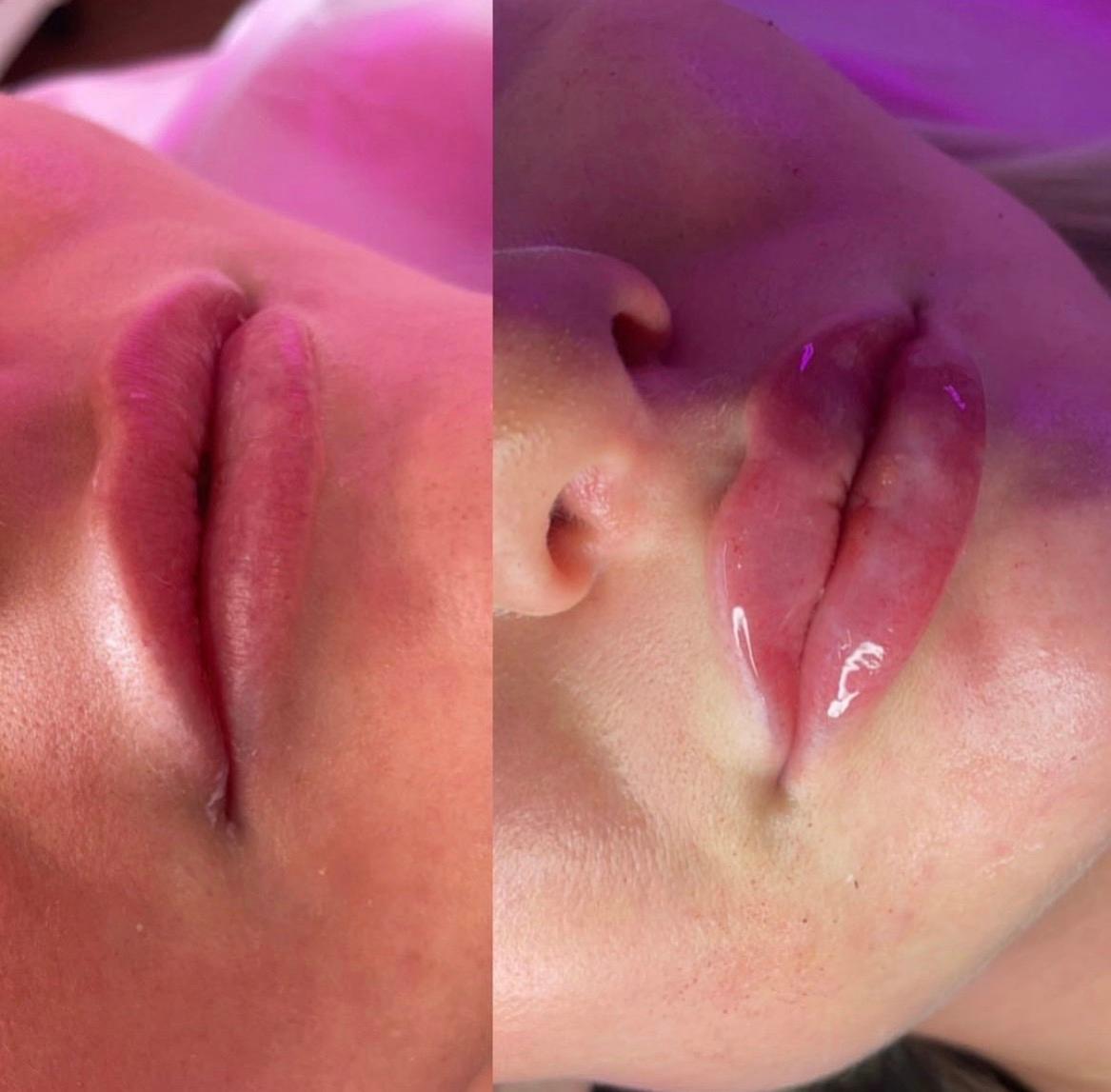 Glow Up With Maya Aesthetics Clinic image 3