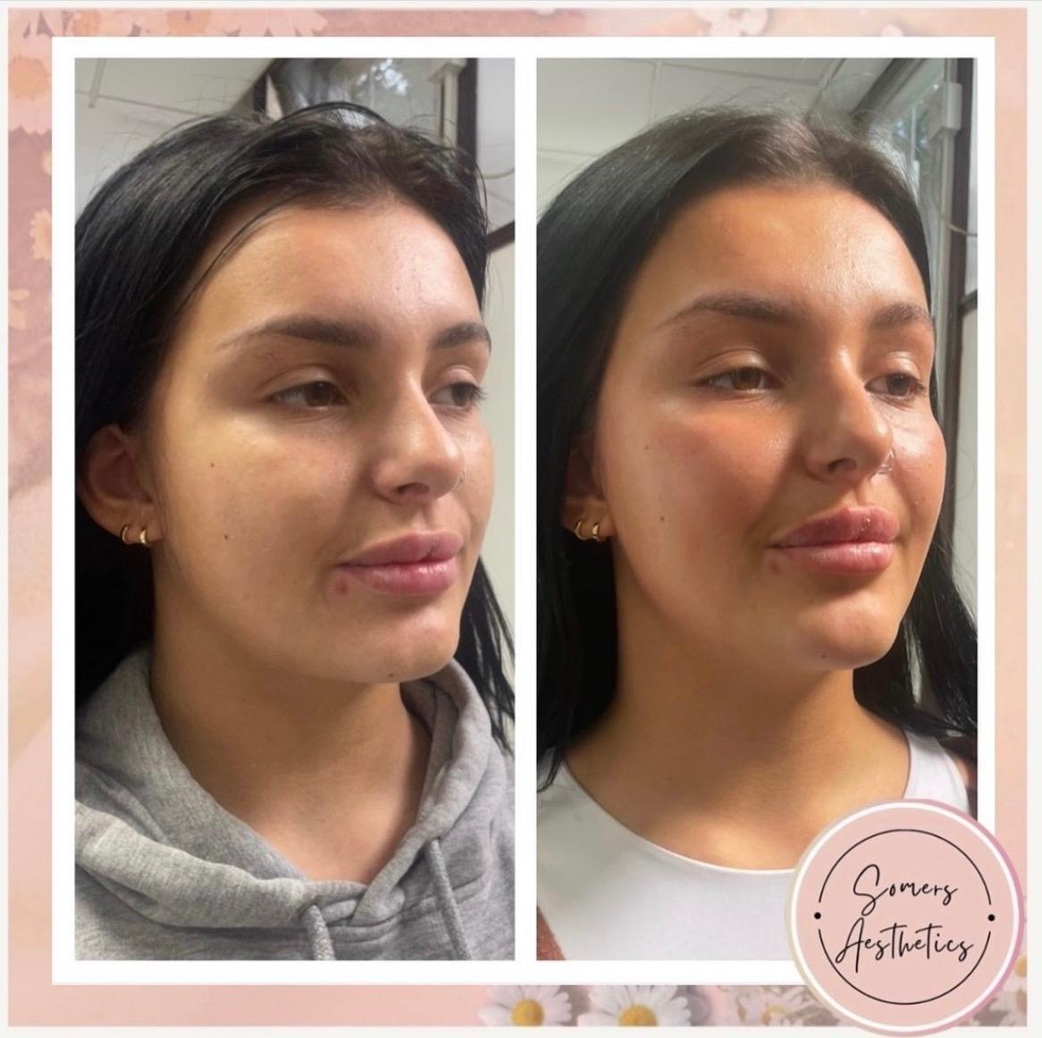 Somers Aesthetics image 2