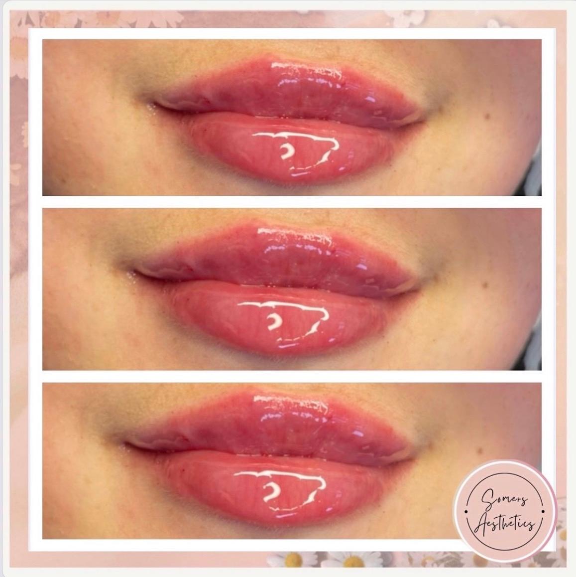Somers Aesthetics image 1