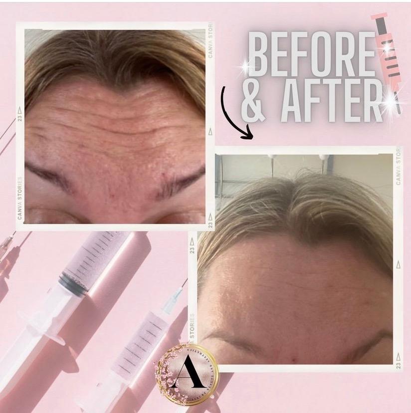 Allure Beauty and Aesthetics image 3