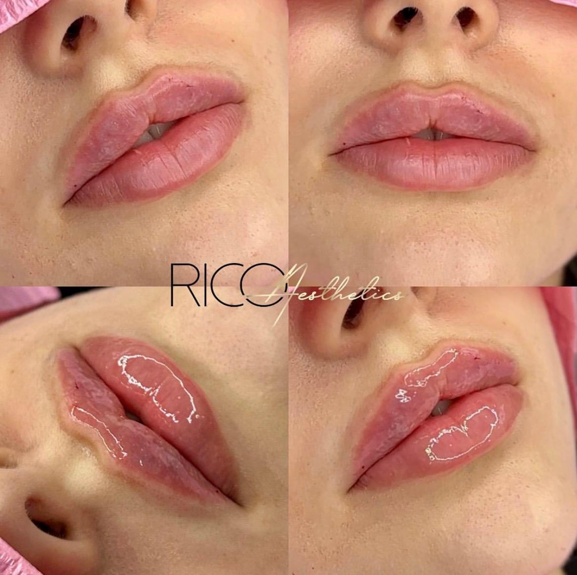 Rico Aesthetics image 3