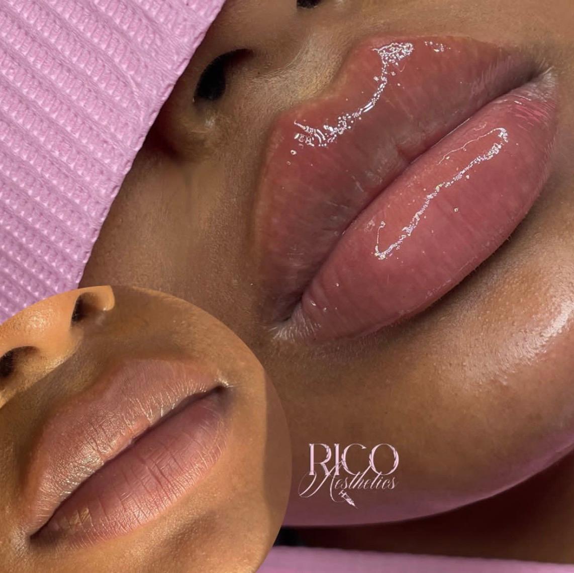 Rico Aesthetics image 2