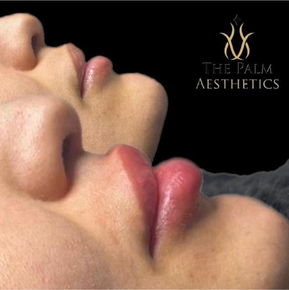 The Palm Aesthetics image 1