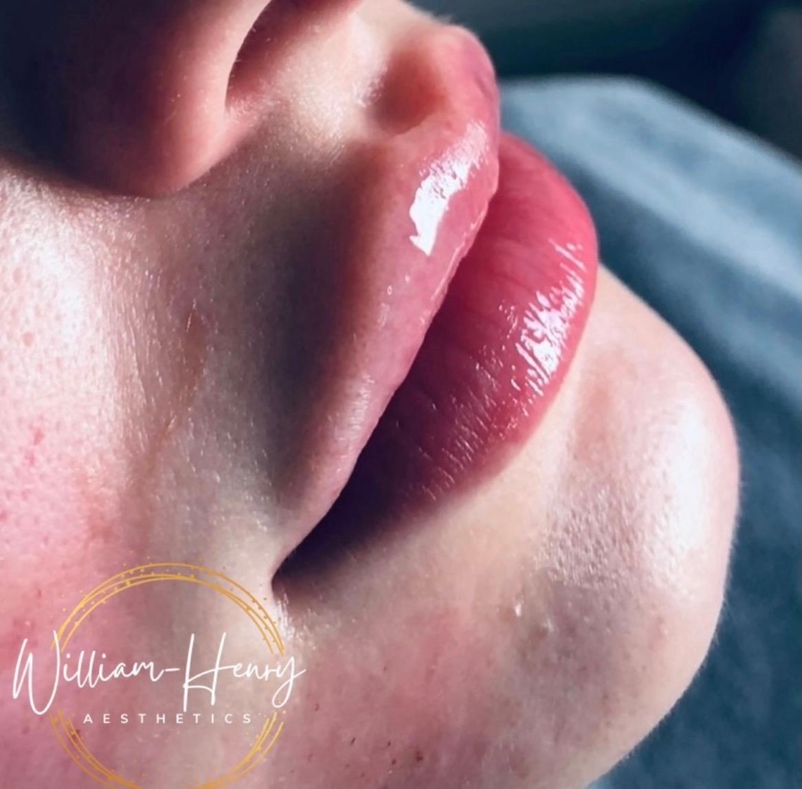 Facial image 3