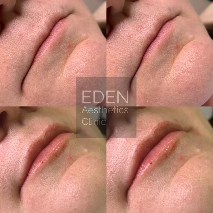Eden Aesthetics Clinic, Essex image 3