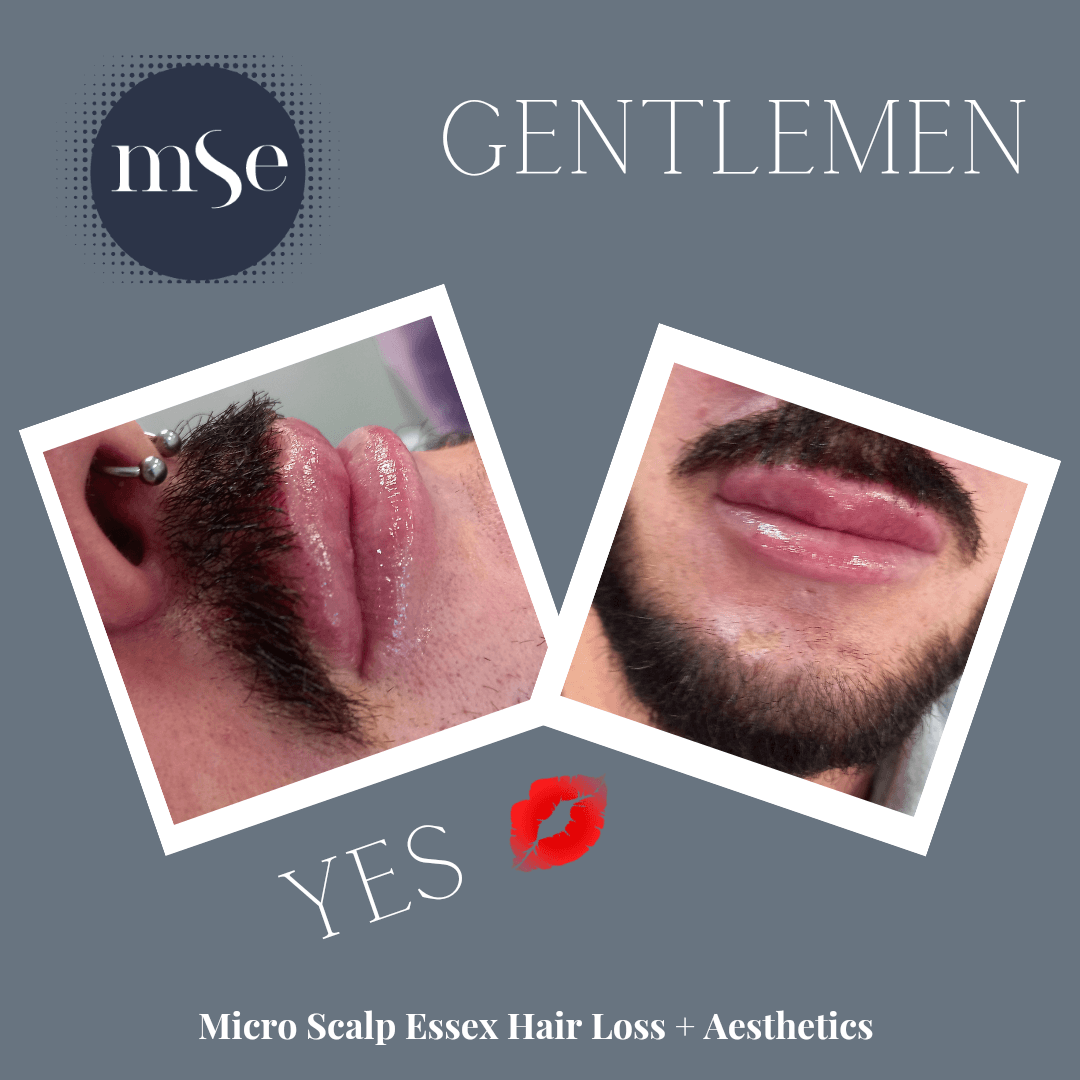 Micro Scalp Essex image 2