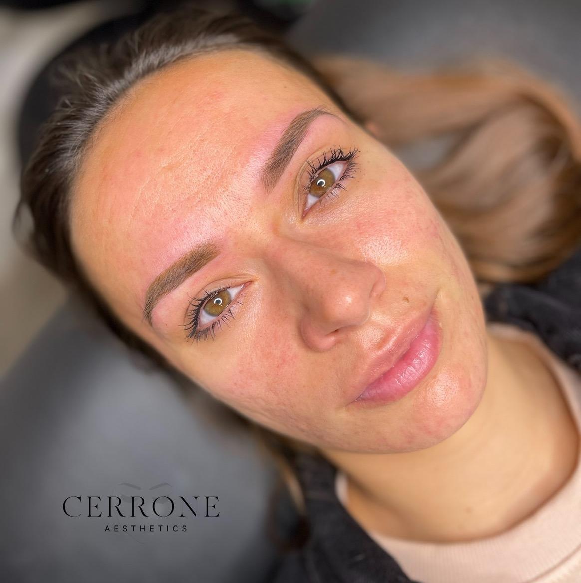 CERRONE Aesthetics image 2