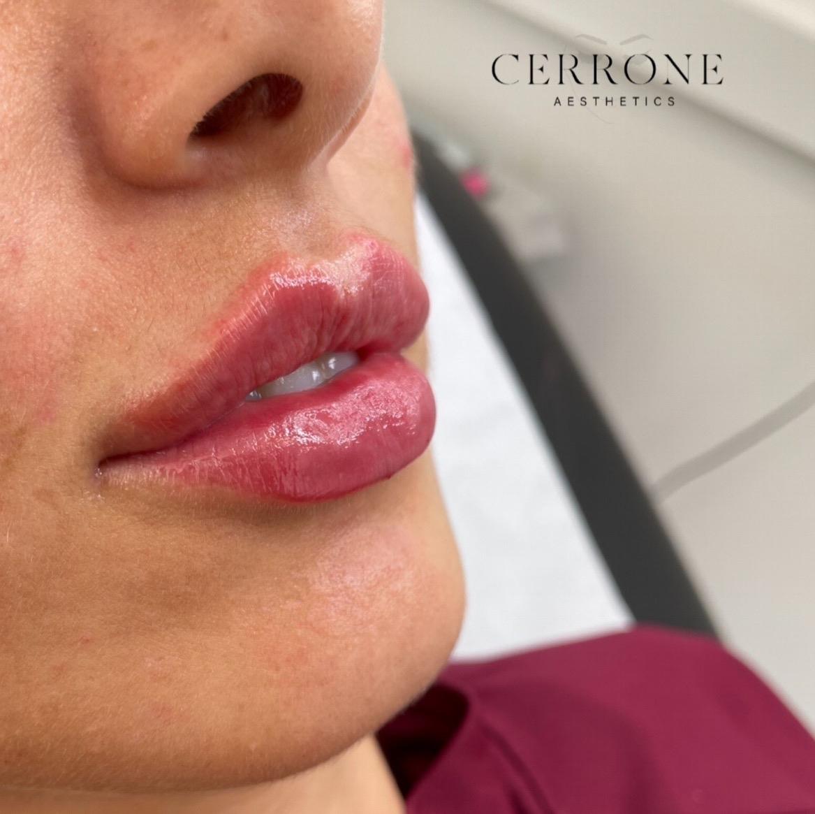 CERRONE Aesthetics image 3