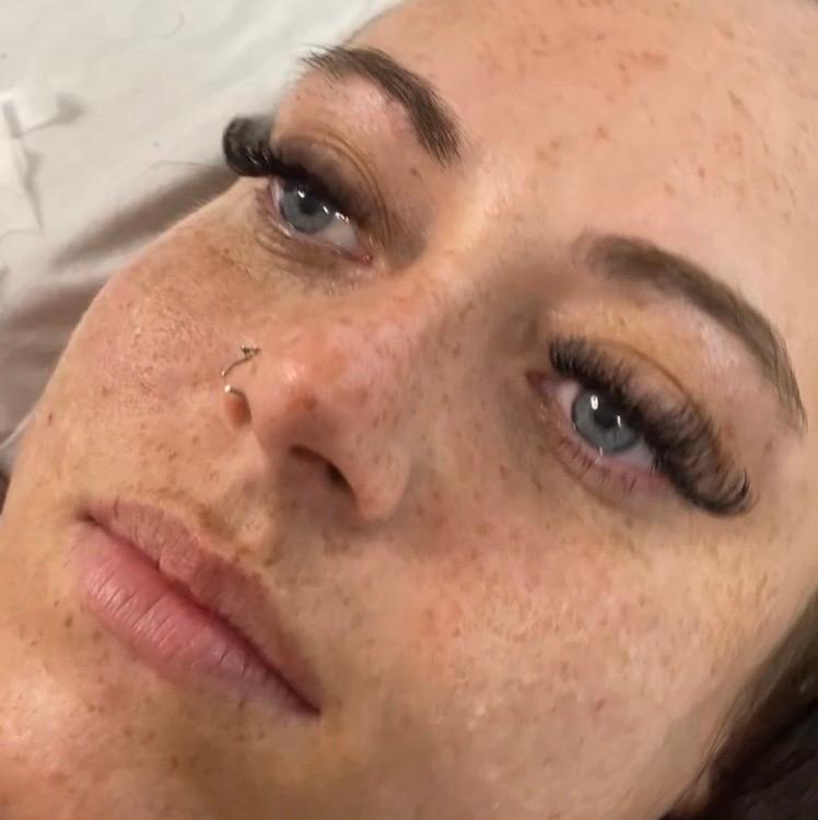 Rbrows clinic image 1