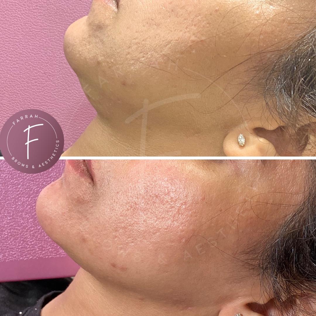 Farrah Brows & Aesthetics image 3