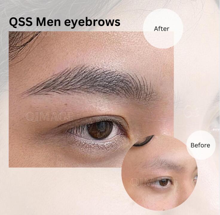 Q image beauty image 3