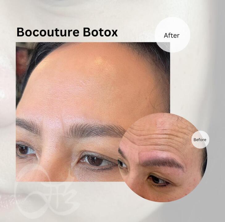 Q image beauty image 2