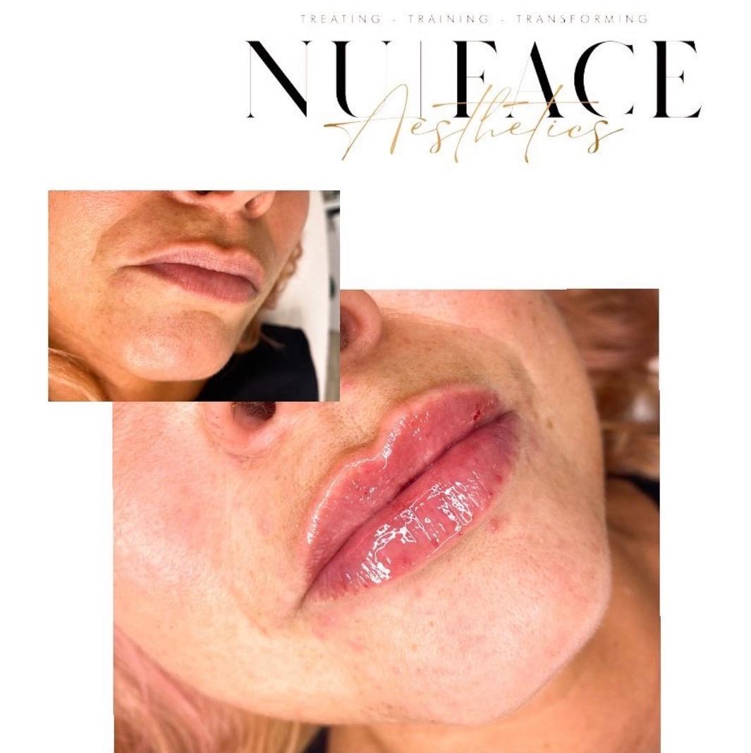 NU:FACE AESTHETICS image 2