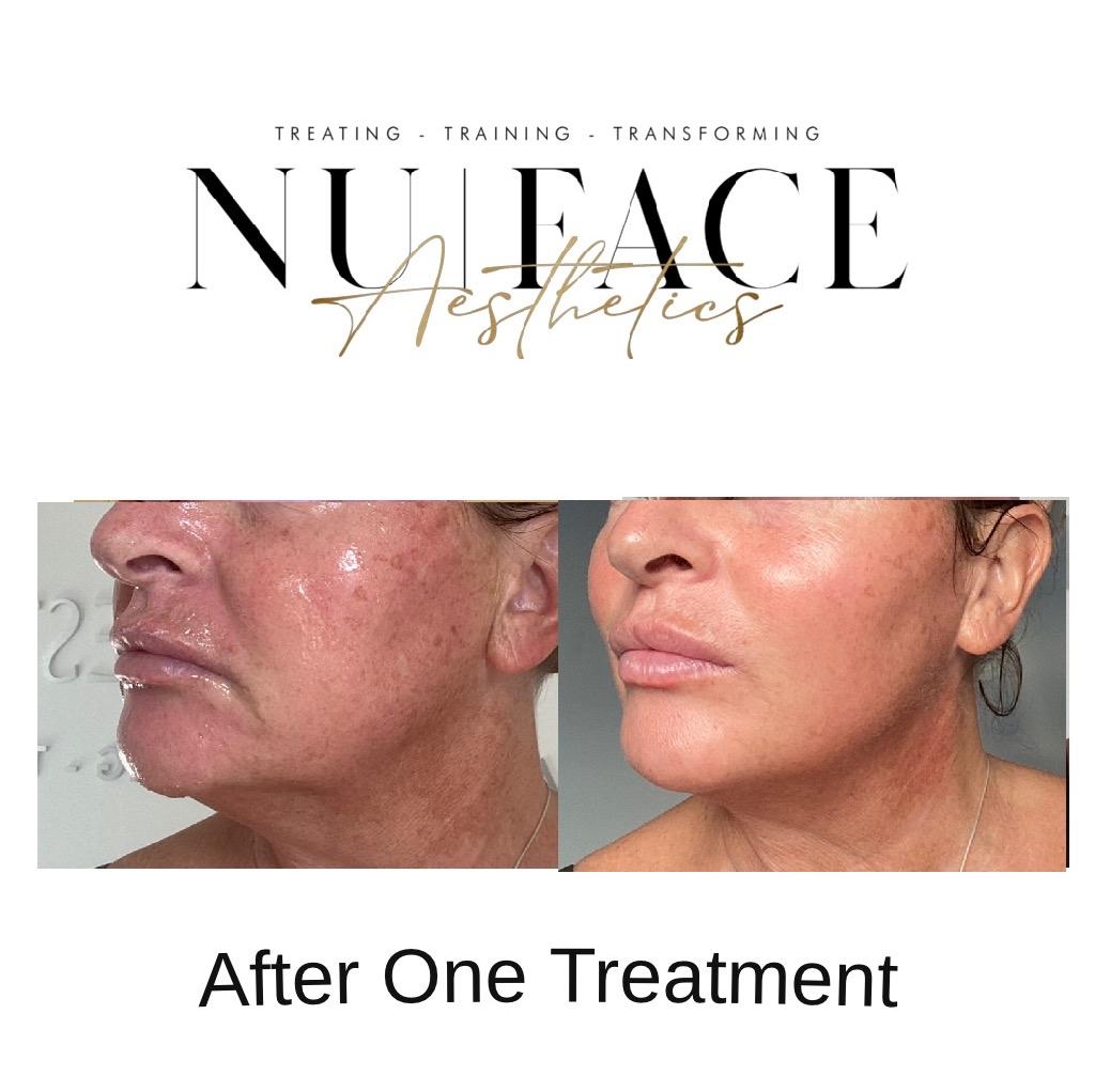 NU:FACE AESTHETICS image 3
