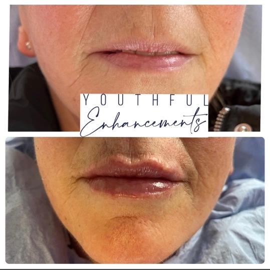 Youthful Enhancements image 3