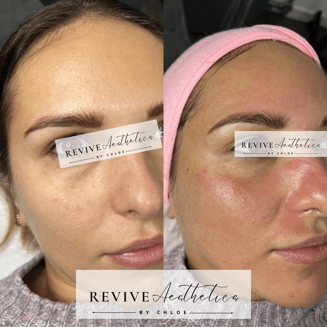 Revive Aesthetics By Chloe image 2