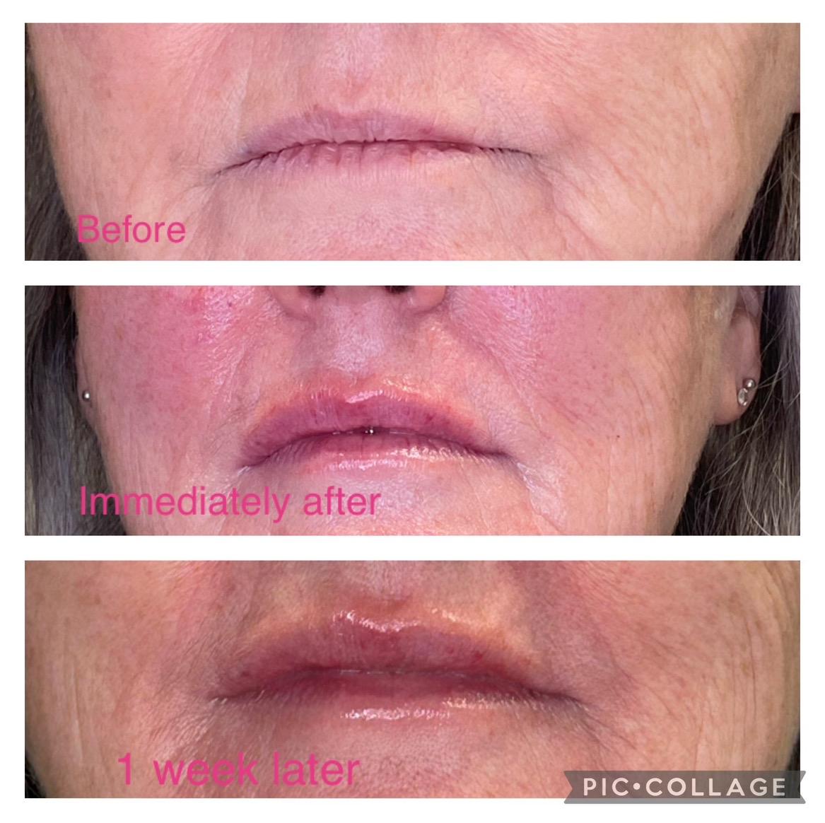 Emma Foster Aesthetics image 2