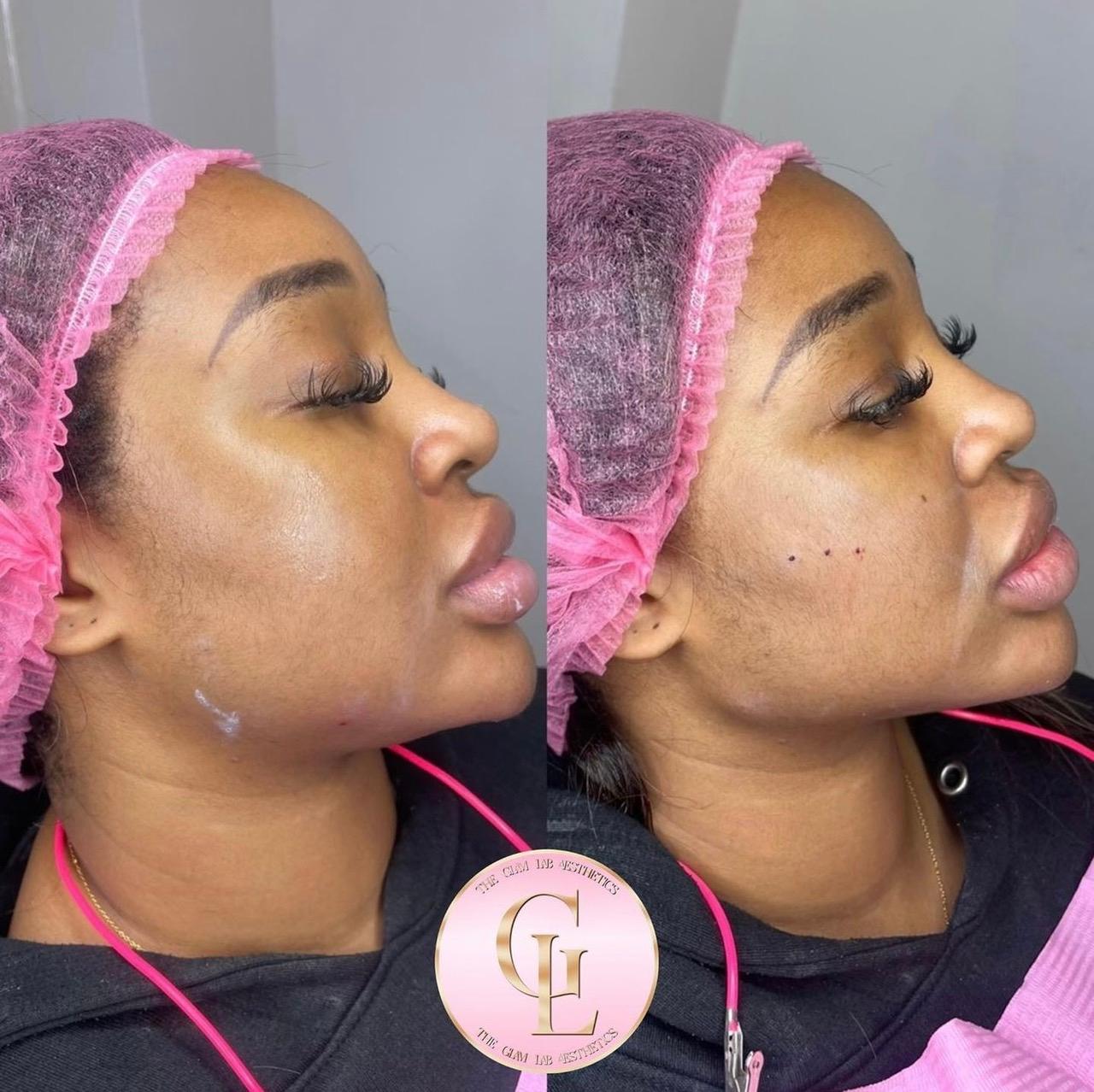 The Glam Lab Aesthetics image 2