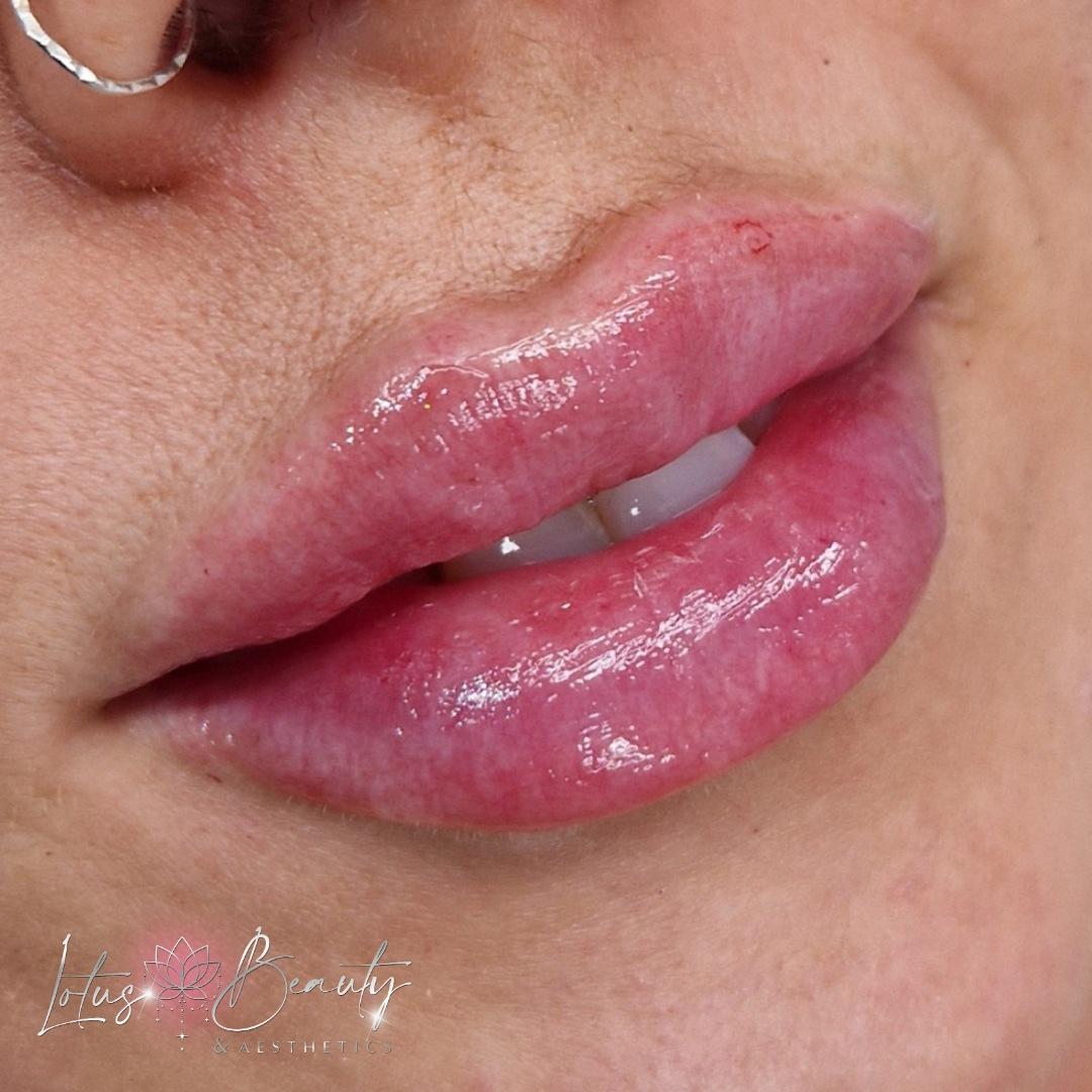 Lotus Beauty image 2